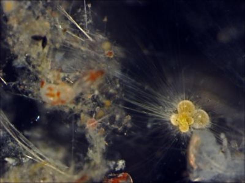  A light microscope image of a yellow-green planktonic foraminifera (bottom right) surrounded by thin strands of its cytoplasm that extend into the surrounding dark blue environment