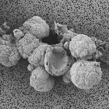 SEM image of carbonate minerals formed by a diatom